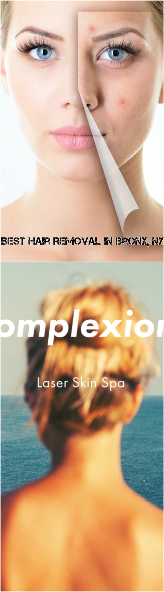 Best Hair Removal In Bronx