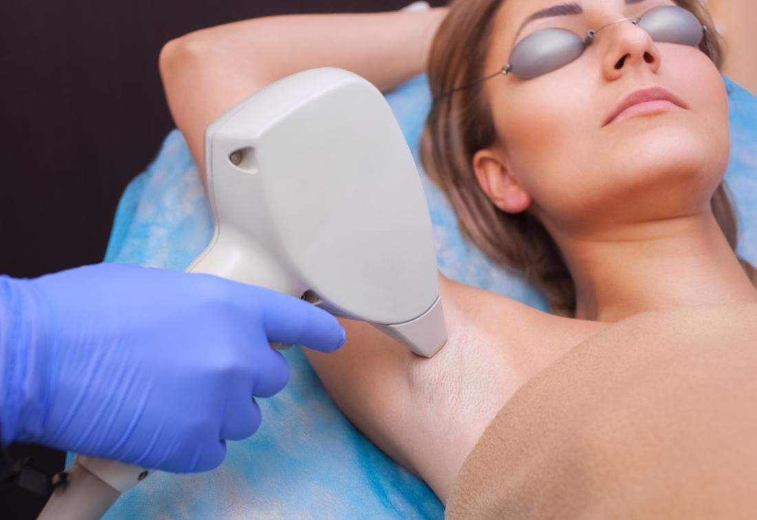 Laser Hair Removal2