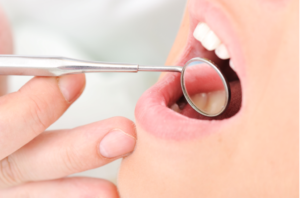 What Are The Most Common Dental Procedures?